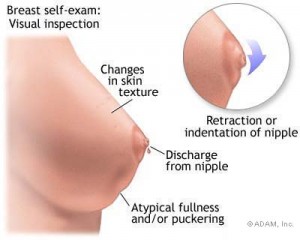 breast cancer image (1)